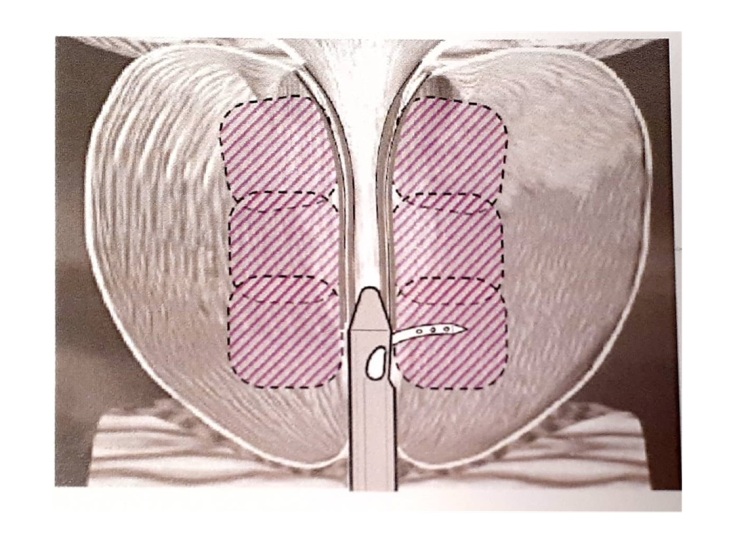 رزوم چگونه کار می‌کند؟